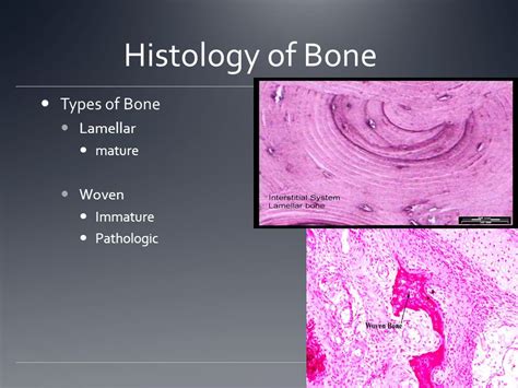 Wu Nov BONE Overview Histology of bone Biology Bone Matrix Blood Supply Repair/Remodeling. - ppt ...