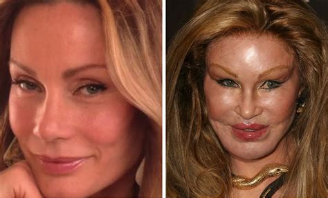 Jocelyn Wildenstein and Donatello Versace Plastic Surgery Gone Wrong | Celebrity Bad Plastics ...