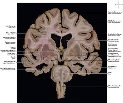 27 Brain Sections | Neupsy Key