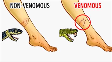 Venomous Snake Diagram