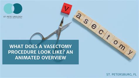 Vasectomy Procedure On Behance