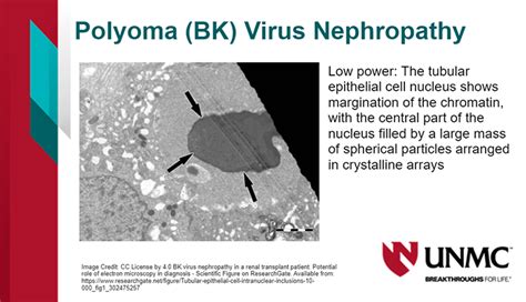 BK virus | E-Gallery | University of Nebraska Medical Center