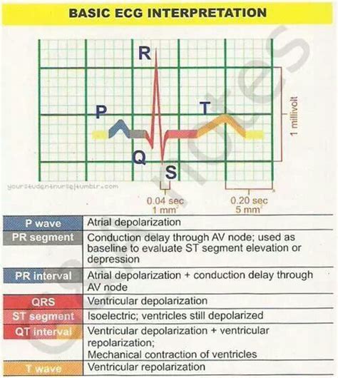 38 best Learning ECG Interpretation images on Pinterest | Nursing schools, Nursing students and ...