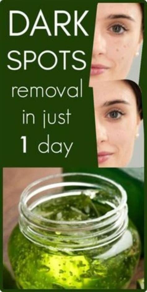 I Got Shocked With The Results Of This Magical Remedy, It Removed Dark Spot In 1 Day | Dark ...