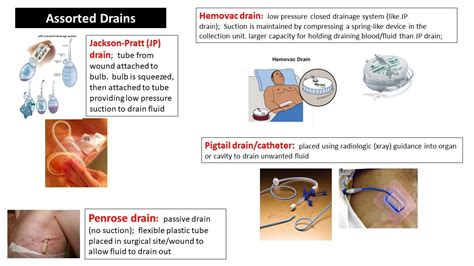 Surgical / Wound Drains Summary | Low pressure, Drains, Pratt