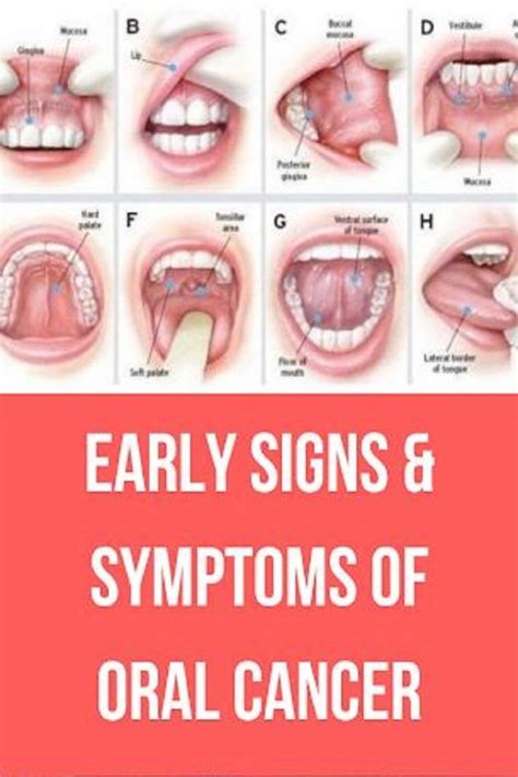 Pin on Emergency Dentist Posts