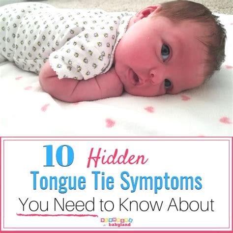 10 Hidden Tongue Tie Symptoms You Need to Know About- Blunders in Babyland