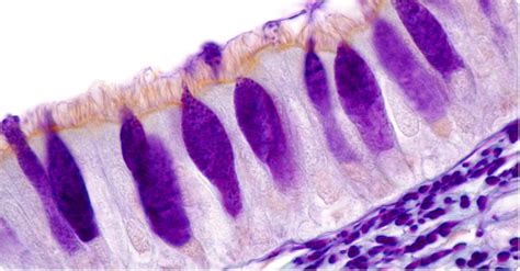 Goblet cells are prime target for SARS-CoV-2, study finds