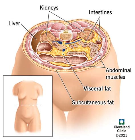 Visceral Fat and Metabolic Health - Metabolic Health