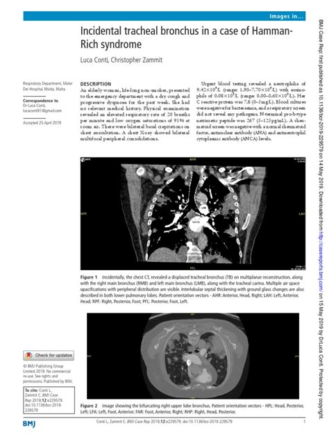 Incidental Tracheal Bronchus in A Case of Hamman-Rich Syndrome | PDF | Respiration | Pulmonology