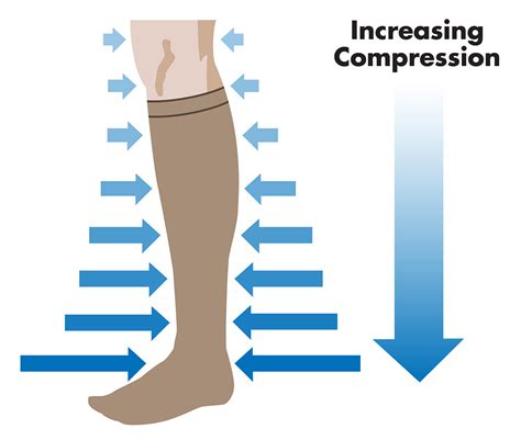 Compression Socks for Varicose Veins - Vein Specialists of the South