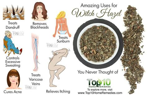 Pin by Happy Happy Joy Joy on Holistic Remedies | Witch hazel uses, Excessive sweating, Acne cure