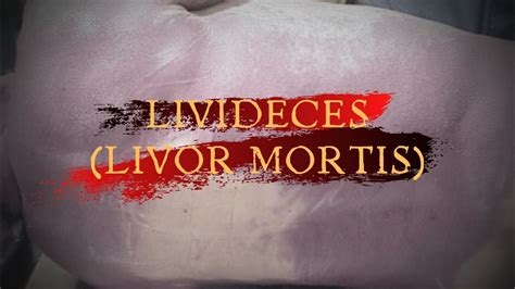 When Does Livor Mortis Start