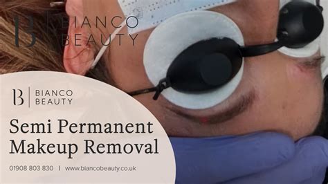 Cosmetic Tattoo Removal in Milton Keynes & Soho London - Bianco Beauty