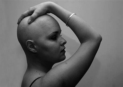 Handling Cancer HairLoss- What Are The Best Practical Options? | HuffPost UK Life