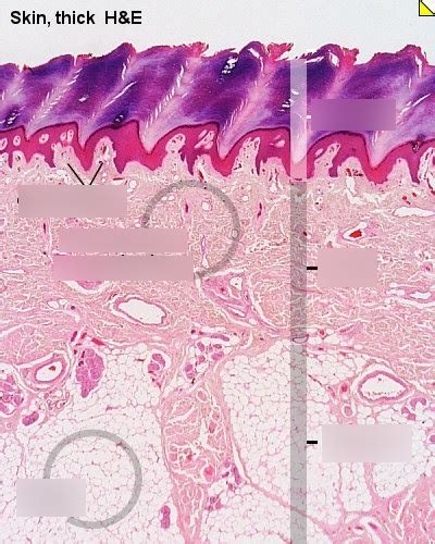 biology 2251 figure 14/ The Hypodermis Diagram | Quizlet