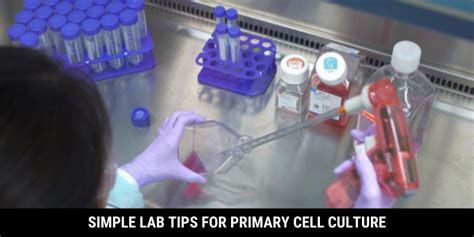 Simple Lab Tips For Primary Cell Culture | Kosheeka