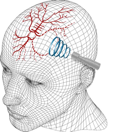 Transcranial Doppler Ultrasound Device (TCD Machine) - Rimed Ltd