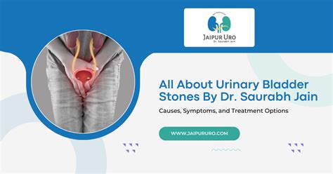 All About Urinary Bladder Stones By Dr. Saurabh Jain | JaipurUro