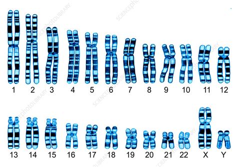 Human Karyotype - Stock Image - C013/0006 - Science Photo Library