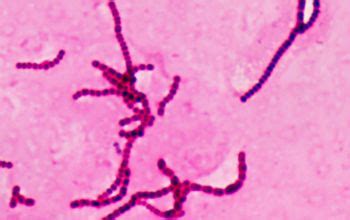 Streptococcus dysgalactiae ssp equisimilis