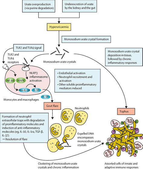 Gout - The Lancet