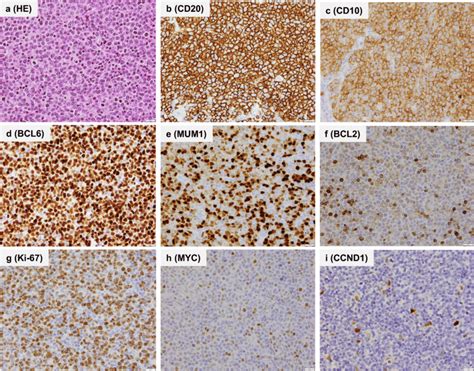 Analysis of lymph node pathology. a Hematoxylin and eosin (H&E ...