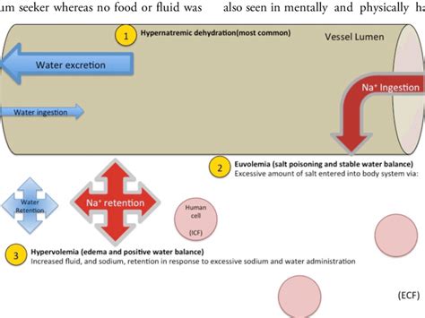 Pathophysiology Of Hypernatremia