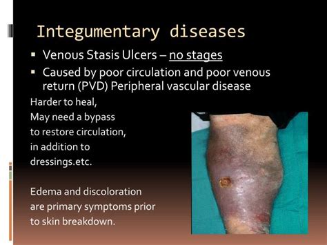 PPT - Selected Integumentary System Diseases & Conditions PowerPoint Presentation - ID:1846654