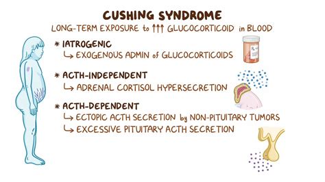 Cushing syndrome and Cushing disease: Clinical sciences - Osmosis Video Library