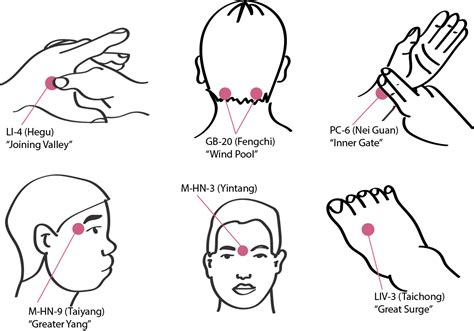 migraine acupressure points - Mend Acupuncture