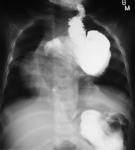 Learning Radiology