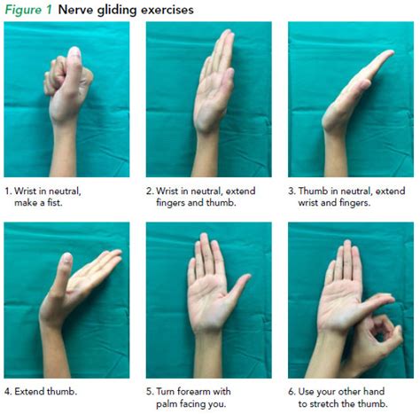 Carpal tunnel syndrome - nerve gliding exercises - SGH