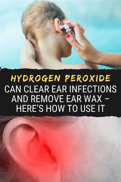 Hydrogen Peroxide Can Clear Ear Infections and Remove Ear Wax – Here’s How to Use it | Health ...