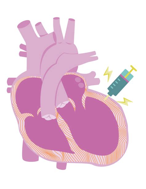 Cardiotoxicity – myactioneducation.org