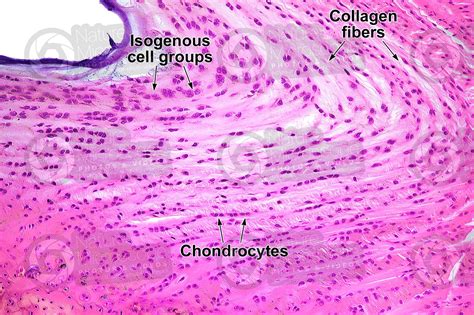 Mammal. Fibrocartilage. Transverse section. 125X - Fibrocartilage - Cartilage - Animal histology ...