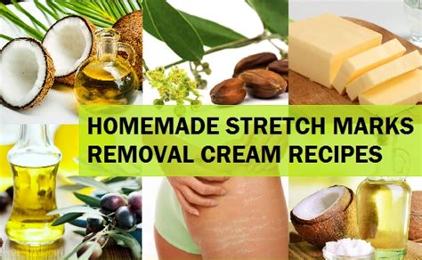 4 Homemade Natural Stretch Marks Removal Cream Recipes