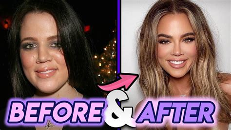 Khloe Kardashian Before : Khloe Kardashian Before and After Plastic ...