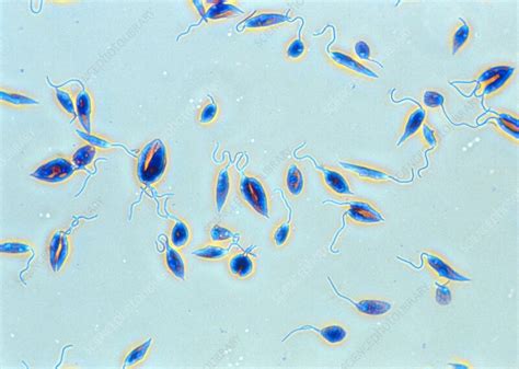 Leishmania donovani, light micrograph - Stock Image - C055/6375 ...