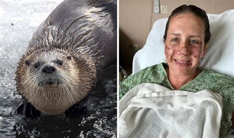 Woman in desperate battle for survival after 'vicious' otter attack ...