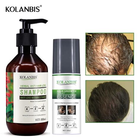 Hair Loss Treatment Kit Oily Growth Fast Serum Hair Loss Shampoo Men Baldness Thickening Product ...