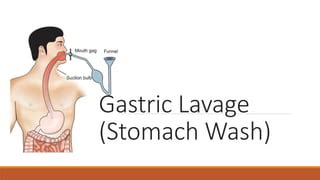 Gastric lavage | PPT