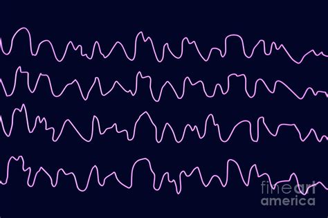 Brain Waves During Sleep Photograph by Kateryna Kon/science Photo ...