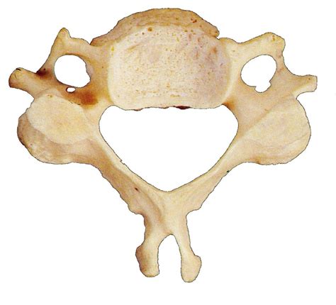 Typical Cervical Vertebrae Anatomy (C3 - C7) Diagram | Quizlet