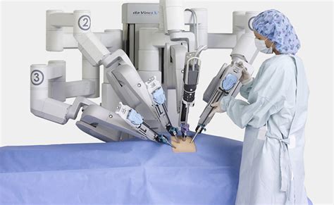 Robot completes 2-hour brain surgery in just 2.5 minutes – Impact Lab