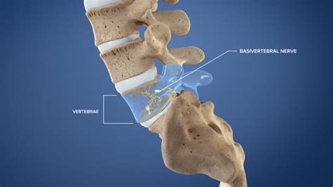 Dr. Giuffrida Reveals The Latest Procedure For Lower Back Problems