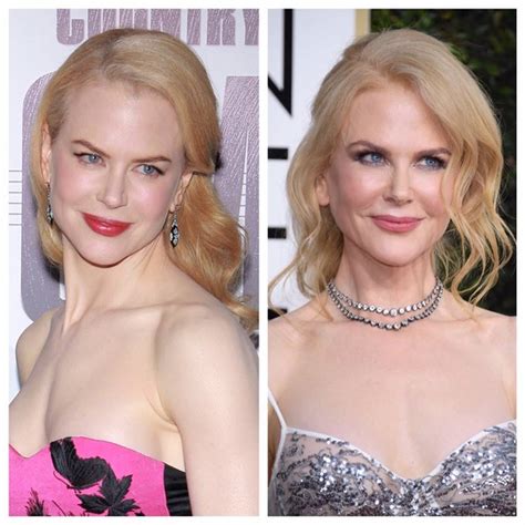 Nicole Kidman’s Before and After Photos Look Different, but She Denied ...