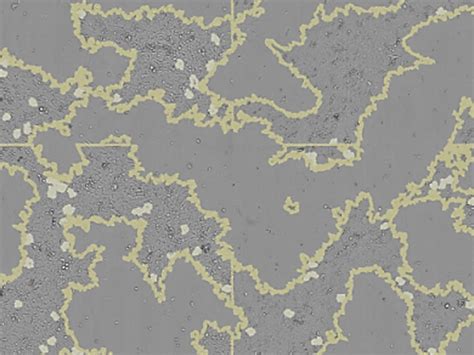 Viral Plaque Assay – Influence of Viruses - BPES | Bioprocess Equipment Specialists