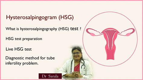 HSG test live,hysterosalpingogram,best treatment and diagnostic method for tube infertility ...