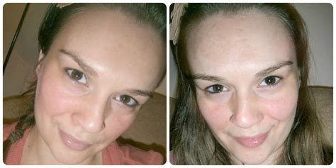 beautiful me plus you: My first Glycolic peel - and it didn't hurt at ...